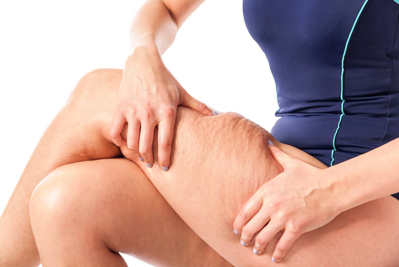 A woman struggling with loose, crepey skin