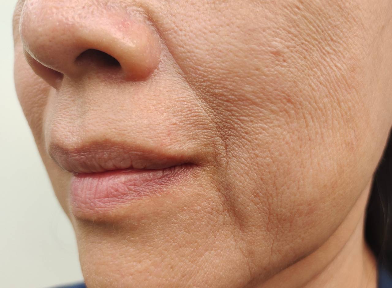 Up close at crepey skin on a woman's face